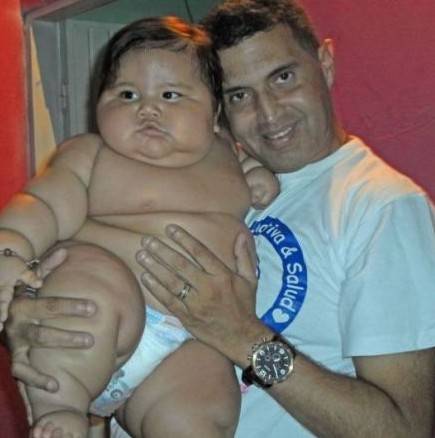 Най-тежкото бебе на света-20 кг на 8-месечна възраст